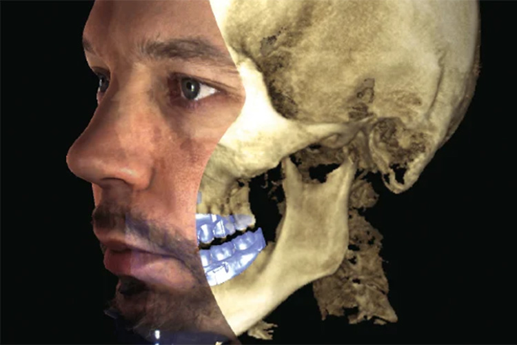 初診の相談(無料)